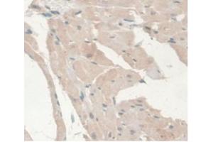 IHC-P analysis of Rat Heart Tissue, with DAB staining. (Androgen Receptor Antikörper  (AA 491-679))