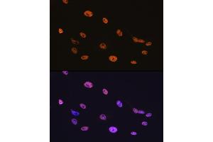 Immunofluorescence (IF) image for anti-TAR DNA Binding Protein (TARDBP) antibody (ABIN7270730)