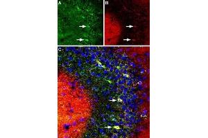 Multiplex staining of DPP6 and KV4. (Dipeptidyl-Peptidase 6 (DPP6) Peptid)