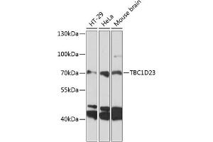Western blot analysis of extracts of various cell lines, using TBC1D23 antibody (ABIN6133202, ABIN6148882, ABIN6148883 and ABIN6224939) at 1:3000 dilution. (TBC1D23 Antikörper  (AA 250-600))