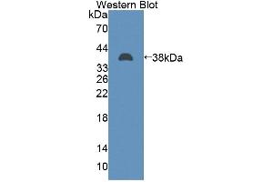 Western Blotting (WB) image for anti-TAF2 RNA Polymerase II, TATA Box Binding Protein (TBP)-Associated Factor, 150kDa (TAF2) (AA 918-1199) antibody (ABIN5014384)