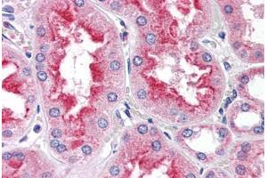 Human Kidney (formalin-fixed, paraffin-embedded) stained with SMAD9 antibody ABIN337365 at 5 ug/ml followed by biotinylated anti-goat IgG secondary antibody ABIN481715, alkaline phosphatase-streptavidin and chromogen. (SMAD9 Antikörper  (AA 166-179))