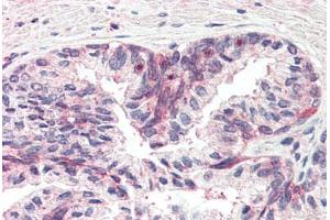 Human Prostate (formalin-fixed, paraffin-embedded) stained with MSX1 antibody ABIN337116 at 2. (MSX1 Antikörper  (AA 8-19))