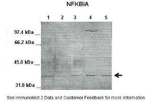 Lanes:   1. (NFKBIA Antikörper  (Middle Region))