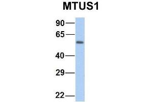 Western Blotting (WB) image for anti-Microtubule Associated Tumor Suppressor 1 (MTUS1) (Middle Region) antibody (ABIN2781855)