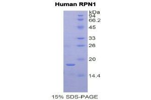 SDS-PAGE (SDS) image for Ribophorin 1 (RPN1) (AA 308-438) protein (His tag) (ABIN2122025)