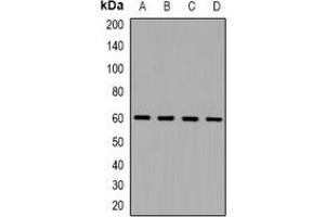 Western blot analysis of NOX1 expression in Hela (A), HEK293T (B), NIH3T3 (C), Mouse kidney (D) whole cell lysates. (NOX1 Antikörper)