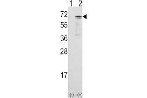 Western Blotting (WB) image for anti-Calcium/calmodulin-Dependent Protein Kinase Kinase 1, alpha (CAMKK1) antibody (ABIN3003480) (CAMKK1 Antikörper)
