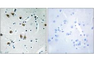 Immunohistochemistry analysis of paraffin-embedded human brain tissue, using ZNF148 Antibody. (ZNF148 Antikörper  (AA 61-110))