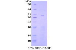 SDS-PAGE analysis of Human Adenylate Cyclase 3 Protein.