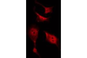 ABIN6267480 staining SW626 by IF/ICC. (CTNNB1 Antikörper  (pTyr489))