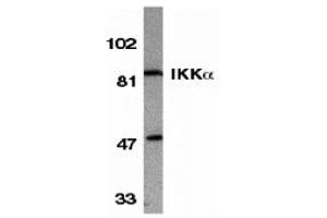 Western Blotting (WB) image for anti-conserved Helix-Loop-Helix Ubiquitous Kinase (CHUK) antibody (ABIN1030202) (IKK alpha Antikörper)