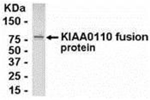 Western Blotting (WB) image for anti-MAD2L1 Binding Protein (MAD2L1BP) (AA 1-126) antibody (ABIN2468117) (MAD2L1BP Antikörper  (AA 1-126))