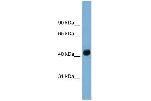 WB Suggested Anti-KIAA1704 Antibody Titration: 0. (GPALPP1 Antikörper  (Middle Region))