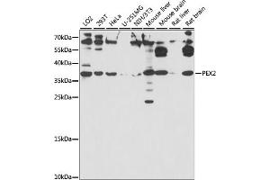 Western blot analysis of extracts of various cell lines, using PEX2 antibody (ABIN7269248) at 1:1000 dilution. (PEX2 Antikörper  (AA 1-130))