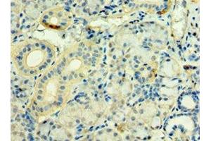 Immunohistochemistry of paraffin-embedded human pancreatic tissue using ABIN7171263 at dilution of 1:100 (STXBP3 Antikörper  (AA 343-592))
