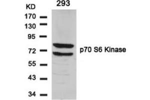 Image no. 3 for anti-Ribosomal Protein S6 Kinase, 70kDa, Polypeptide 1 (RPS6KB1) (Ser424) antibody (ABIN197548) (RPS6KB1 Antikörper  (Ser424))