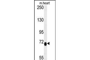 LCA5L Antibody (C-term) (ABIN653975 and ABIN2843921) western blot analysis in mouse heart tissue lysates (15 μg/lane). (LCA5L Antikörper  (C-Term))