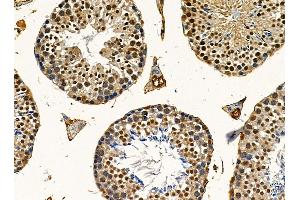 ABIN7095488 and ABIN7099545 at 1/100 staining mouse testis tissue by IHC-P. (UBXN7 Antikörper)
