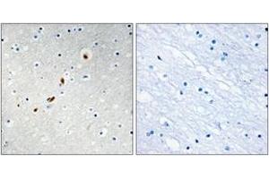 Immunohistochemistry analysis of paraffin-embedded human brain tissue, using ZNF596 Antibody. (ZNF596 Antikörper  (AA 261-310))