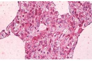 Anti-ABCB7 antibody IHC staining of human lung, alveoli. (ABCB7 Antikörper  (AA 691-740))