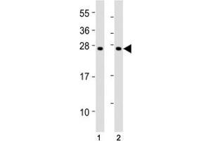 Western Blotting (WB) image for anti-Suppressor of Cytokine Signaling 1 (SOCS1) (AA 35-66) antibody (ABIN3029042)
