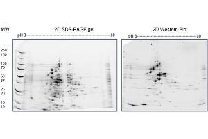 2D SDS-PAGE: Load/Strip: 100 μg E. (Combined Host Cell Proteins Antikörper)