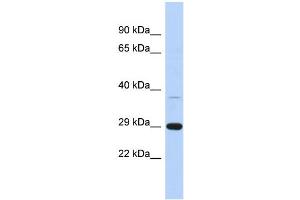 WB Suggested Anti-C1orf74 Antibody Titration: 0. (C1ORF74 Antikörper  (N-Term))