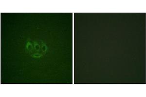 Immunofluorescence staining of methanol-fixed A549 cells using ACK1 (Phospho-Tyr284) Antibody. (TNK2 Antikörper  (pTyr284))