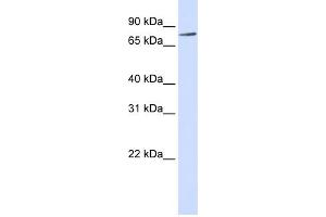 WB Suggested Anti-RIPK4 Antibody Titration:  0. (RIPK4 Antikörper  (Middle Region))