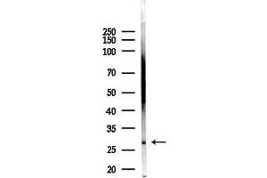 anti-Glutathione Transferase zeta 1 (Maleylacetoacetate Isomerase) (GSTZ1) (C-Term) antibody