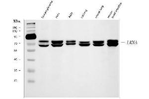 Western blot analysis of Lamin A+C/LMNA using anti-Lamin A+C/LMNA antibody (ABIN7601843).