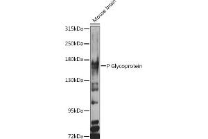 Western blot analysis of extracts of various cell lines, using P Glycoprotein antibody (ABIN6129943, ABIN6136341, ABIN6136344 and ABIN6216612) at 1:1000 dilution. (ABCB1 Antikörper  (AA 630-710))