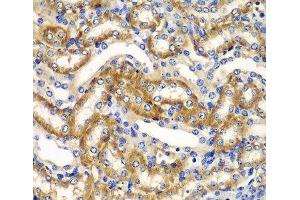 Immunohistochemistry of paraffin-embedded Mouse kidney using ZFAND3 Polyclonal Antibody at dilution of 1:100 (40x lens). (ZFAND3 Antikörper)