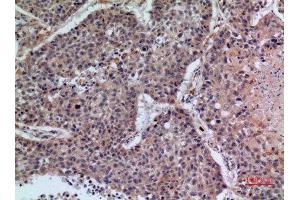 Immunohistochemistry (IHC) analysis of paraffin-embedded Human Lung, antibody was diluted at 1:100.