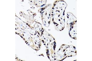 Immunohistochemistry of paraffin-embedded human placenta using A Rabbit pAb (ABIN6129868, ABIN6136479, ABIN6136480 and ABIN6221034) at dilution of 1:100 (40x lens). (BAF53A Antikörper  (AA 1-280))