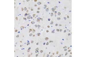 Immunohistochemistry of paraffin-embedded rat brain using IL13 antibody (ABIN5971115) (40x lens). (IL-13 Antikörper)