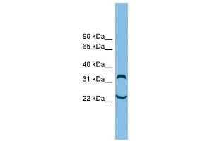 C6orf134 antibody used at 1 ug/ml to detect target protein.