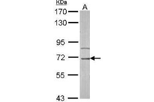 WB Image Sample (50 ug of whole cell lysate) A: mouse liver 7. (IRAK3 Antikörper)