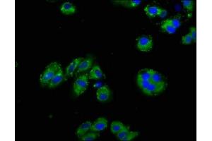 Immunofluorescence staining of HepG2 cells with ABIN7161148 at 1:125, counter-stained with DAPI. (Nephrin Antikörper  (AA 23-257))