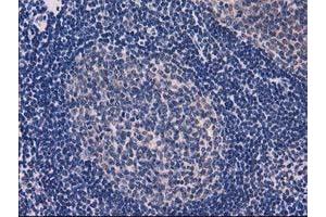 Image no. 3 for anti-Eukaryotic Translation Initiation Factor 4E Family Member 2 (EIF4E2) antibody (ABIN1497992) (EIF4E2 Antikörper)