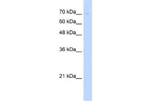 WB Suggested Anti-UNC93B1 Antibody Titration:  5. (UNC93B1 Antikörper  (N-Term))
