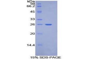 SDS-PAGE analysis of Mouse Torsin 2A Protein.