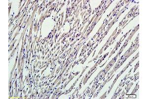 Formalin-fixed and paraffin embedded mouse myocardium labeled with (ABIN737271) Rabbit Anti-Nrf2 Polyclonal Antibody, Unconjugated 1:300 followed by conjugation to the secondary antibody and DAB staining (NRF2 Antikörper  (AA 430-480))