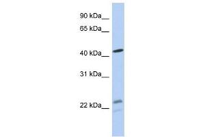 BCKDHA antibody used at 1 ug/ml to detect target protein.