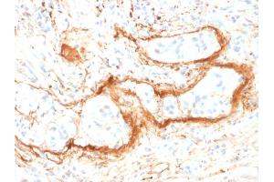 Formalin-fixed, paraffin-embedded human Small Intestine stained with Monospecific Mouse Monoclonal Antibody (ELN/1981) to Elastin. (Elastin Antikörper)