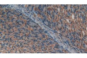 Immunohistochemistry (IHC) image for anti-Endothelial PAS Domain Protein 1 (EPAS1) (AA 21-336) antibody (ABIN7435526)