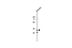 Anti-TMEM106B Antibody (C-Term) at 1:2000 dilution + Mouse brain lysate Lysates/proteins at 20 μg per lane. (TMEM106B Antikörper  (AA 218-252))