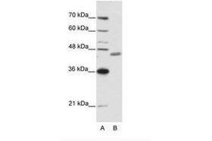 Image no. 1 for anti-Zinc Finger Protein 396 (ZNF396) (N-Term) antibody (ABIN6736192) (ZNF396 Antikörper  (N-Term))