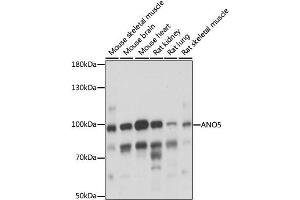 anti-Anoctamin 5 (ANO5) antibody